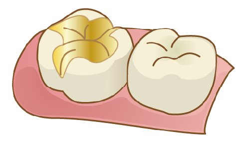 ゴールド