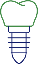 インプラント