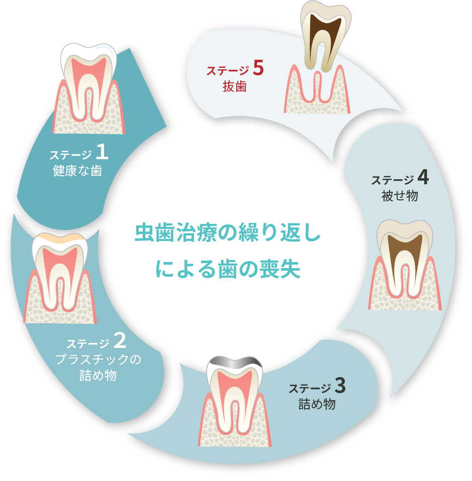 予防プログラムを導入