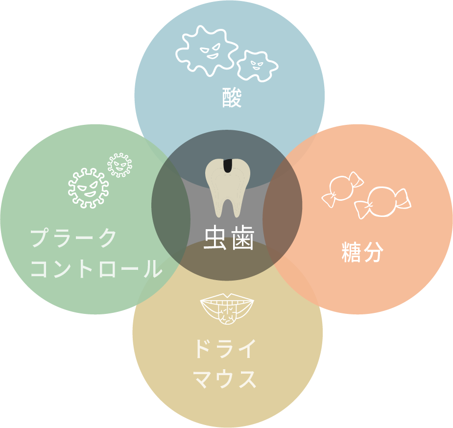 虫歯ができる原因