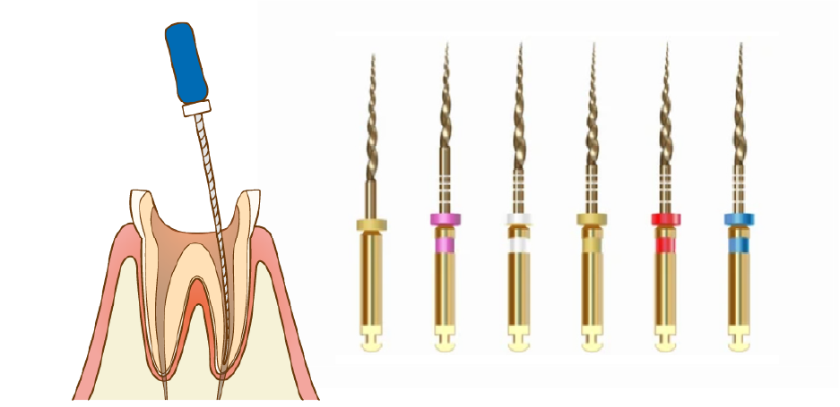 ニッケルチタンファイル