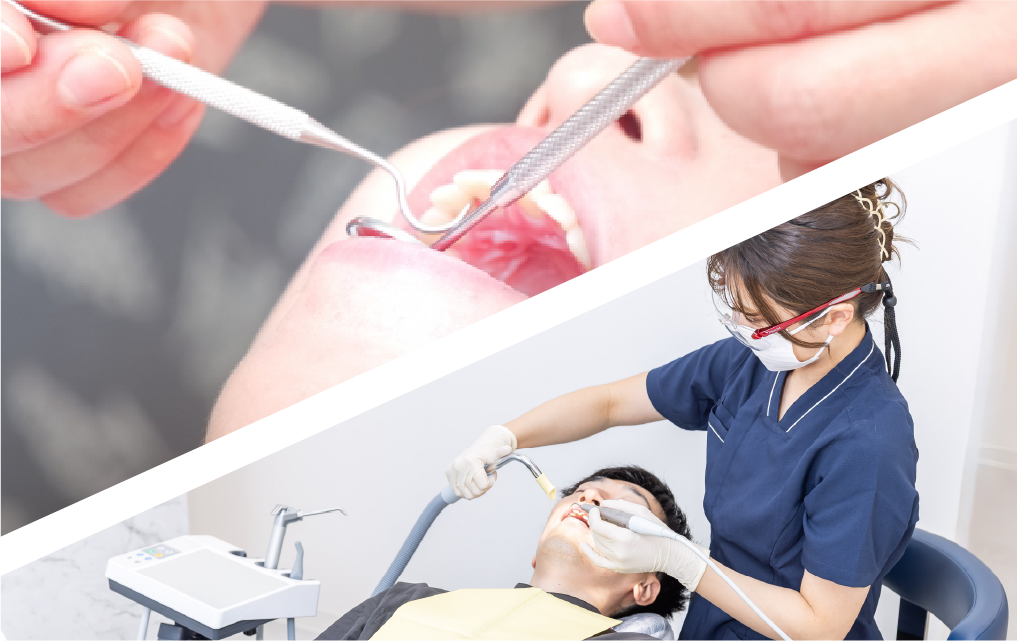 予防プログラムを導入