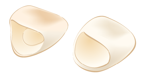 オールセラミック