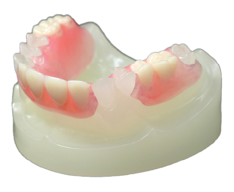 ノンクラスプデンチャー