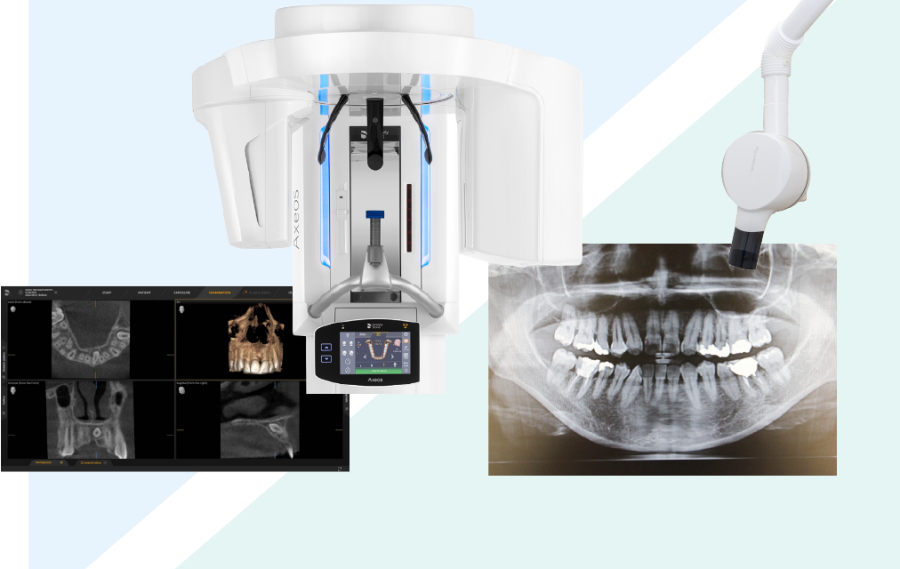 精密検査により抜歯の必要性を適切に診断